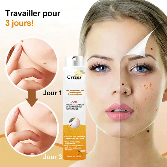 Vente du dernier jour 50 % de réduction🎁 Spray de traitement pour l'élimination des verrues et des acrochordons au venin d'abeille Cvreoz™🎁