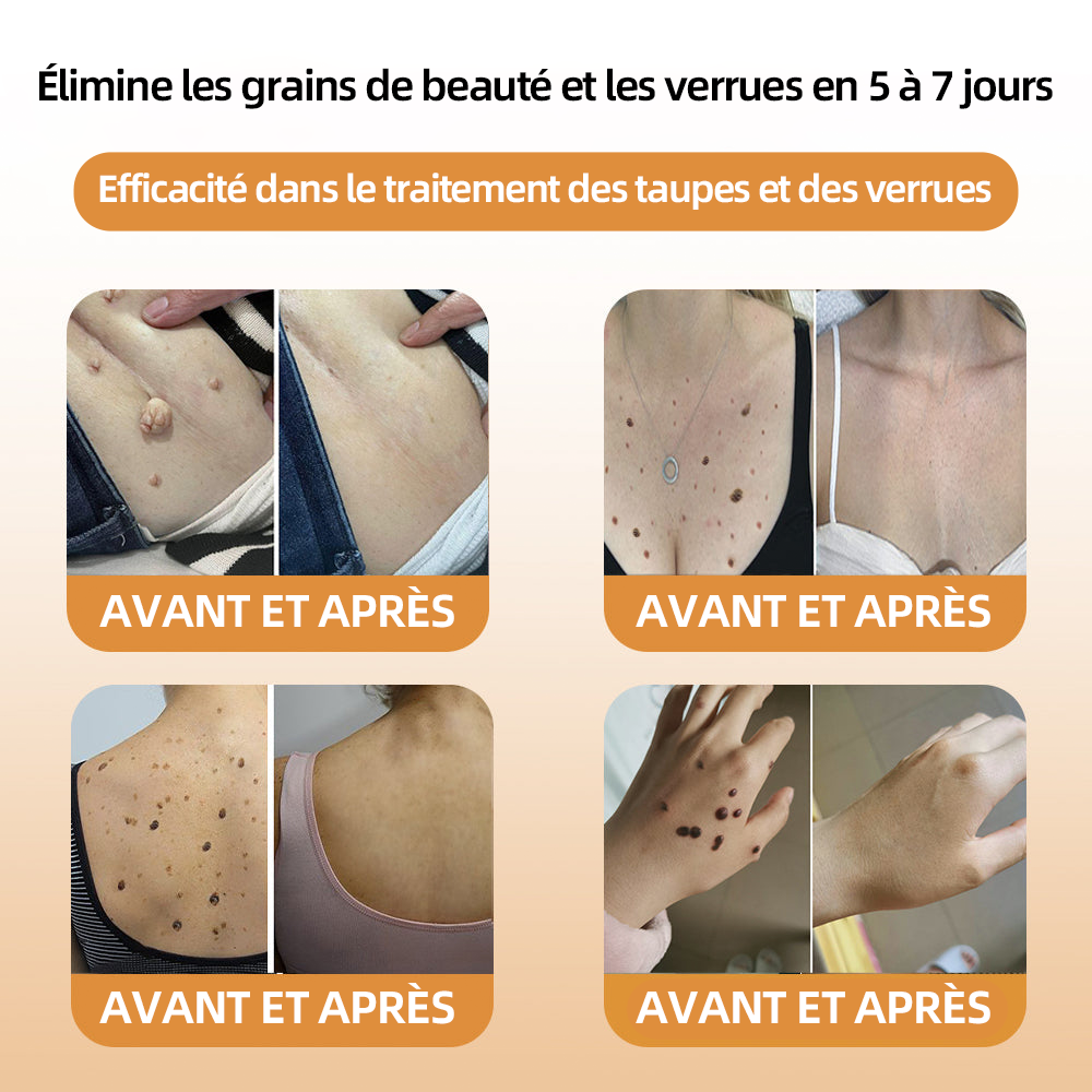 [Boutique officielle de ls marque] 𝘾𝙧è𝙢𝙚 𝙙𝙚 𝙩𝙧𝙖𝙞𝙩𝙚𝙢𝙚𝙣𝙩 𝙖𝙪 𝙫𝙚𝙣𝙞𝙣 𝙙’𝙖𝙗𝙚𝙞𝙡𝙡𝙚 𝙏𝙪𝙧𝙤𝙣𝙪™🙆(👨‍⚕ ⚕𝗔𝗔𝗗 𝗥𝗘𝗖𝗢𝗠𝗠𝗔𝗡𝗗É)