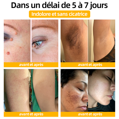 [Boutique officielle de ls marque] 𝘾𝙧è𝙢𝙚 𝙙𝙚 𝙩𝙧𝙖𝙞𝙩𝙚𝙢𝙚𝙣𝙩 𝙖𝙪 𝙫𝙚𝙣𝙞𝙣 𝙙’𝙖𝙗𝙚𝙞𝙡𝙡𝙚 𝙏𝙪𝙧𝙤𝙣𝙪™🙆(👨‍⚕ ⚕𝗔𝗔𝗗 𝗥𝗘𝗖𝗢𝗠𝗠𝗔𝗡𝗗É)