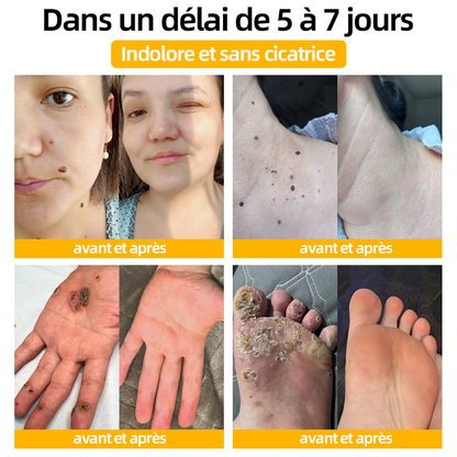 [Boutique officielle de ls marque] 𝘾𝙧è𝙢𝙚 𝙙𝙚 𝙩𝙧𝙖𝙞𝙩𝙚𝙢𝙚𝙣𝙩 𝙖𝙪 𝙫𝙚𝙣𝙞𝙣 𝙙’𝙖𝙗𝙚𝙞𝙡𝙡𝙚 𝙏𝙪𝙧𝙤𝙣𝙪™🙆(👨‍⚕ ⚕𝗔𝗔𝗗 𝗥𝗘𝗖𝗢𝗠𝗠𝗔𝗡𝗗É)