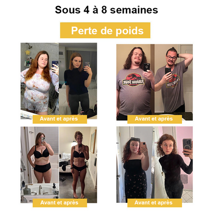 Vente du dernier jour à 50 % de réduction🎁 Anneau de drainage lymphatique et amincissant au venin d'abeille GGPM™🎁