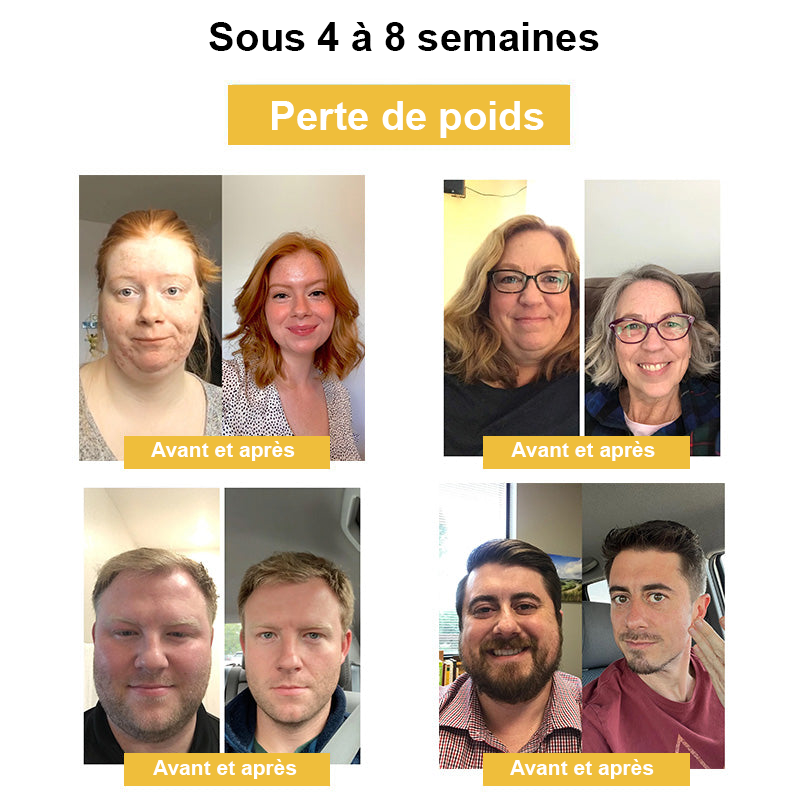 Vente du dernier jour à 50 % de réduction🎁 Anneau de drainage lymphatique et amincissant au venin d'abeille GGPM™🎁