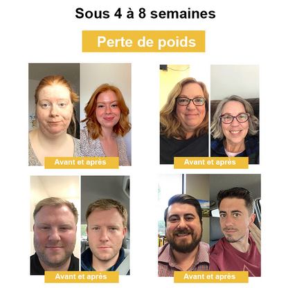 Vente du dernier jour à 50 % de réduction🎁 Anneau de drainage lymphatique et amincissant au venin d'abeille GGPM™🎁